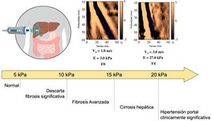 Estimación del grado de fibrosis hepática mediante elastografía de transición y «regla del 5» para el riesgo de cirrosis hepática. Nota: La «regla del 5» hay que tomarla con cautela puesto que no está claramente demostrada, en especial en estudios en población general. Adaptada de 1,2,37.