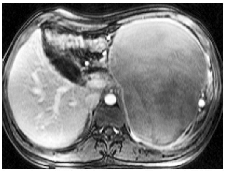 Casos en imagen 1 | Radiología