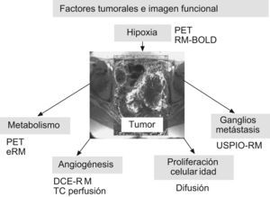 Factores tumorales que definen el comportamiento biológico de una neoplasia y principales medios de imagen para su estudio mediante técnicas funcionales.