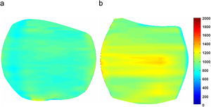 Mapas de T1 con codificación por color. a) Cartílago normal, con mayor uniformidad en toda su área. b) Cartílago con degeneración avanzada, donde se pueden apreciar regiones con un aumento del valor de T1.