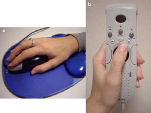 A) Posición adecuada de la mano en el manejo del ratón, con apoyo de almohadilla. B) Modelo de dictáfono como reconocedor de voz, con mandos manejables con un dedo.