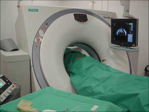 Fotografía de un paciente en decúbito prono en condiciones de máxima esterilidad para un procedimiento de DPDL guiado mediante TC.