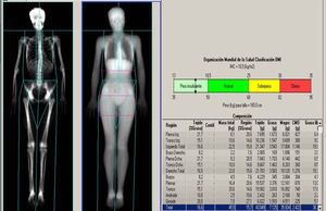 Estudio de absorciometría con rayos X de doble energía de cuerpo entero. Paciente con déficit ponderal.