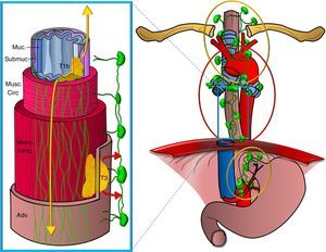 Esquema de las vías de drenaje linfático del esófago. Representación de un segmento del esófago mostrando las distintas capas de la pared (Muc: mucosa; Submuc: submucosa; Musc. circ: muscular circular; Musc. long: muscular longitudinal; Adv: adventicia). Se representan dos tumores que la infiltran, uno de forma superficial hasta la submucosa (T1b) y otro más avanzado (T3), y las redes de drenaje linfático, una en la capa submucosa, más extensa y en sentido longitudinal, que drena en las cadenas del mediastino superior y perigástricas (extensión representada en colores amarillos), y otra en la capa muscular, menos desarrollada, que drena de forma segmentaria en las cadenas periesofágicas (extensión representada en colores rojos).