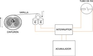 Diagrama simplificado del sincronizador respiratorio. La varilla, conectada mediante una pequeña polea a la cuerda de violín que une los dos extremos del cinturón previamente cortado, al ascender al compás de la expansión torácica (inspiración), sumerge su extremo en forma de U en dos cubetas llenas de mercurio. Este paso cierra el circuito eléctrico que genera los rayos X. El dispositivo podía ajustarse para que el cierre se produjera con la contracción torácica (espiración) y la consiguiente emersión de la U.