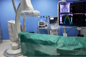 Sala de angiografía preparada, con cobertura plástica del equipo, antes de la llegada del paciente.