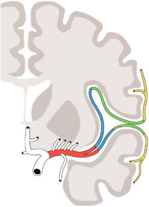 Esquema de la distribución espacial/anatómica de los segmentos de la arteria cerebral media a lo largo de su recorrido intracraneal. Segmentos M1 (en rojo), M2 (en azul), M3 (en verde) y M4 (en amarillo).