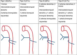 Clasificación de Cauldwell. Patrones de ramificación de las arterias bronquiales.
