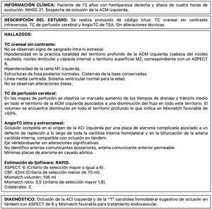 Ejemplo de informe de ictus en el que se describen, por separado, los hallazgos en la TC de cráneo sin contraste por vía intravenosa, la TC de perfusión y la angio-TC.