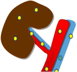 Segmentos arteriales y venosos a valorar mediante ecografía Doppler.