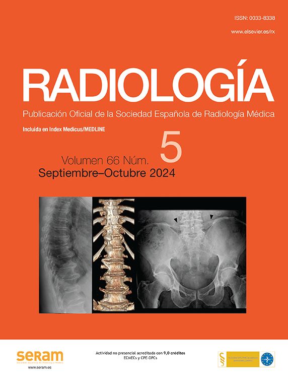 El informe radiológico en la enfermedad de Crohn | Radiología