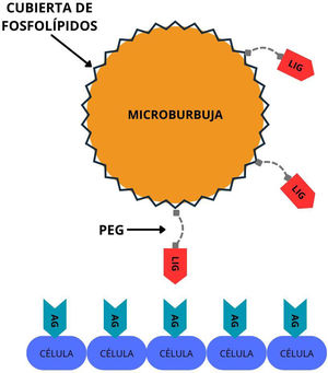 Representación gráfica del mecanismo de acción de las microburbujas marcadas molecularmente. A la microburbuja se le incorpora un ligando (LIG), habitualmente un anticuerpo o péptido de superficie que reconoce los antígenos (AG) expresados por las células. El polietilenglicol (PEG) ayuda a proyectar el ligando desde la superficie de la microburbuja para aumentar su afinidad por el antígeno. Adaptado de referencia37.