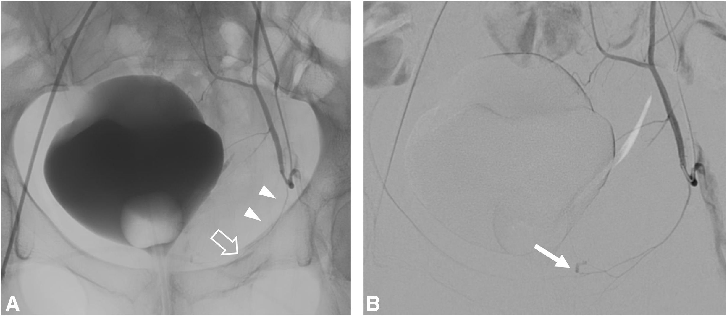 fig0010