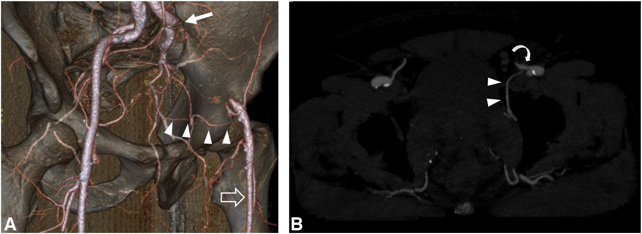 fig0020