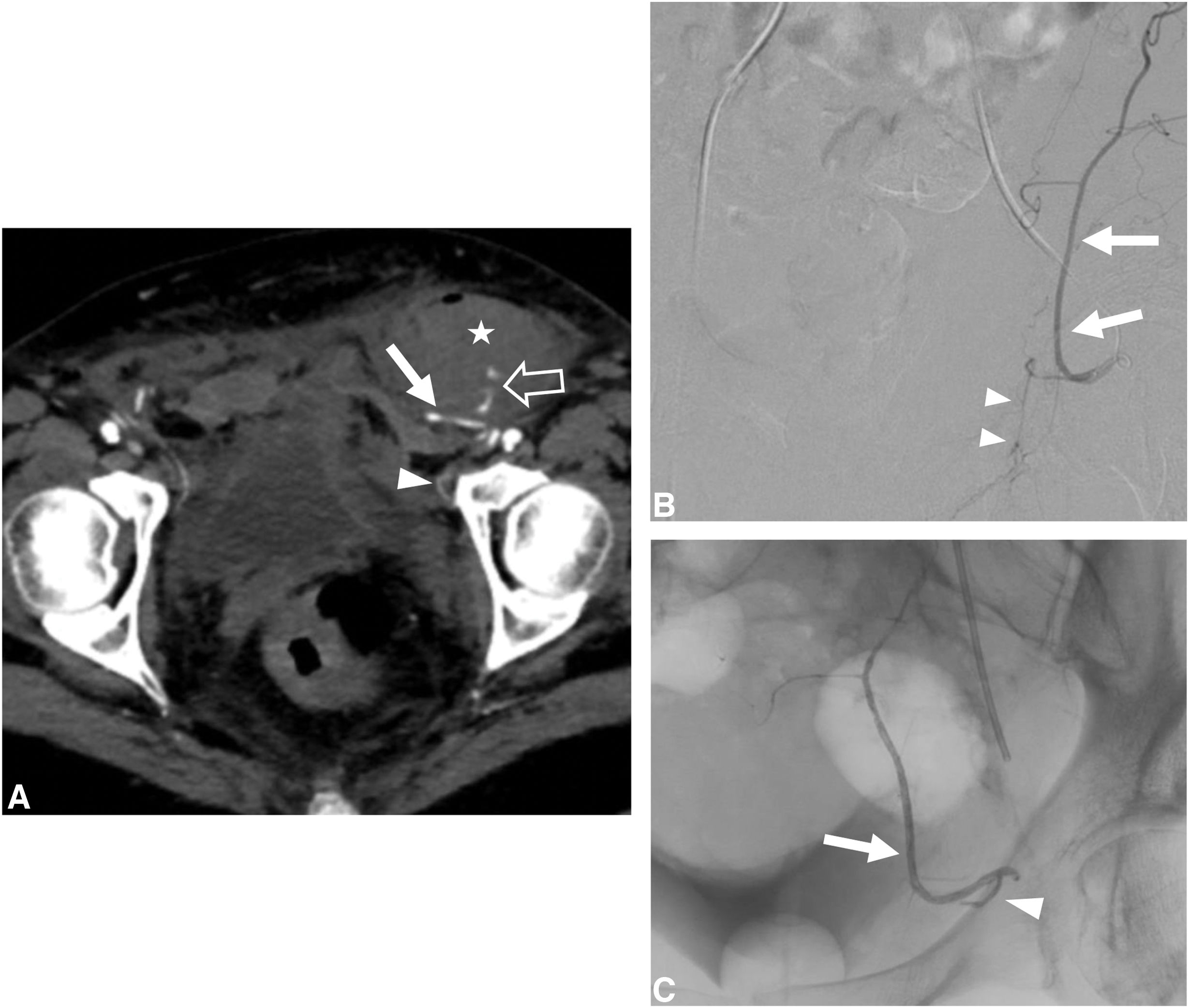 fig0025
