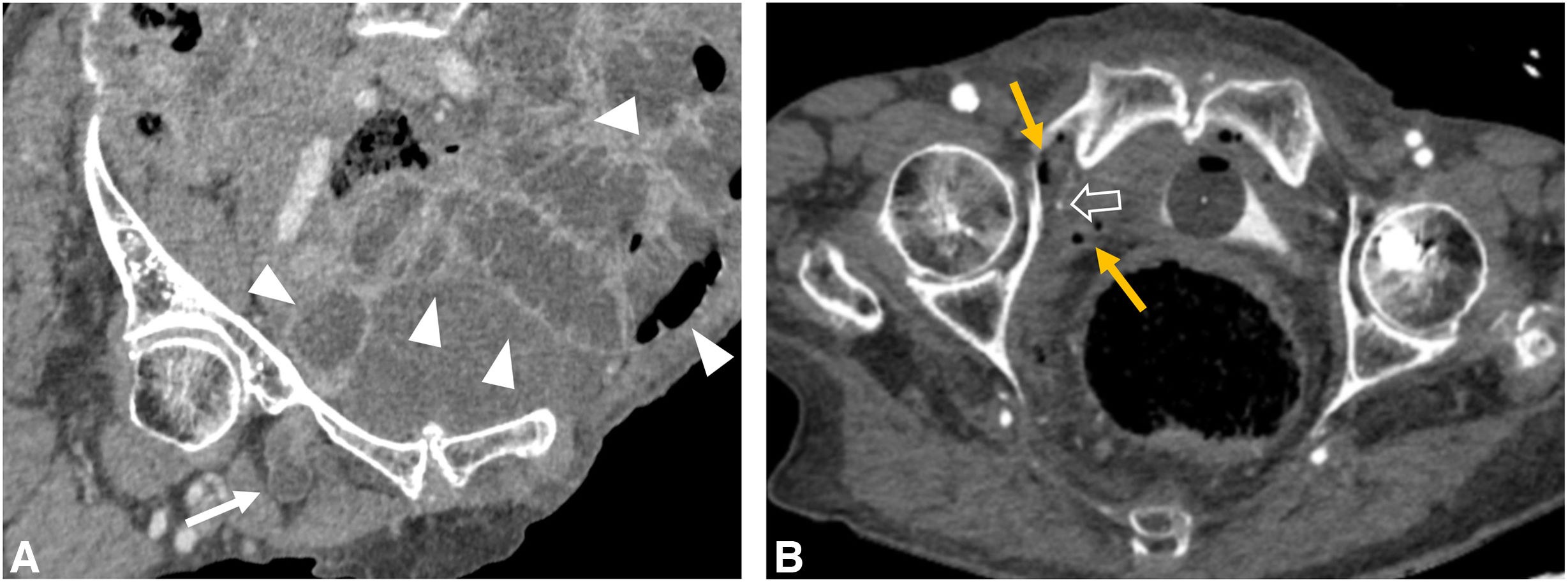 fig0030