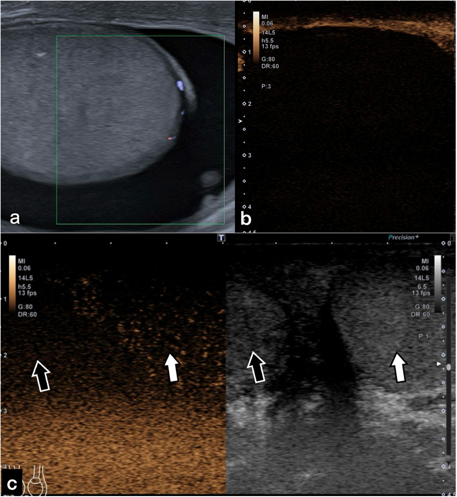 fig0010