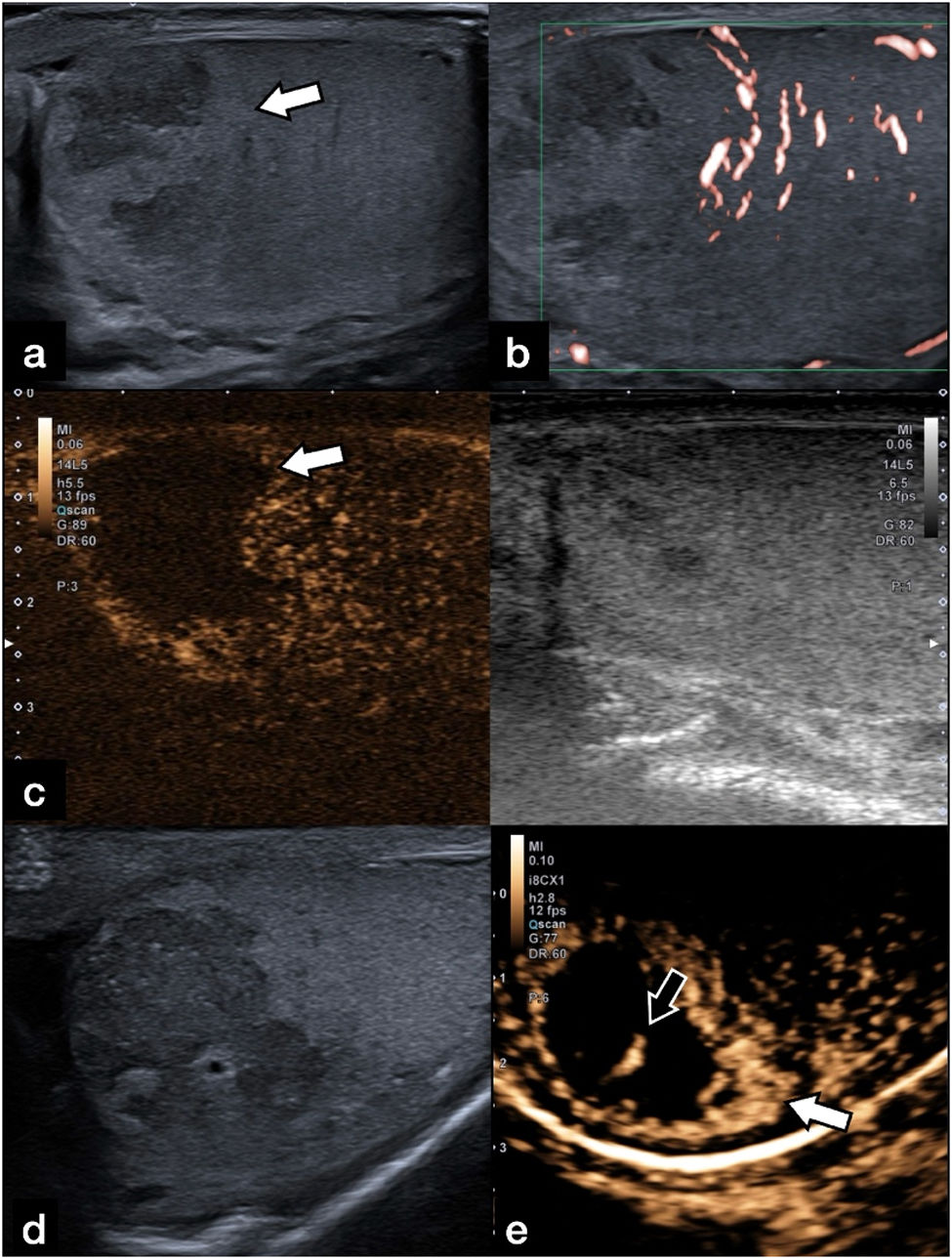 fig0020
