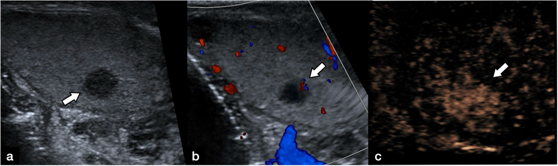 fig0040