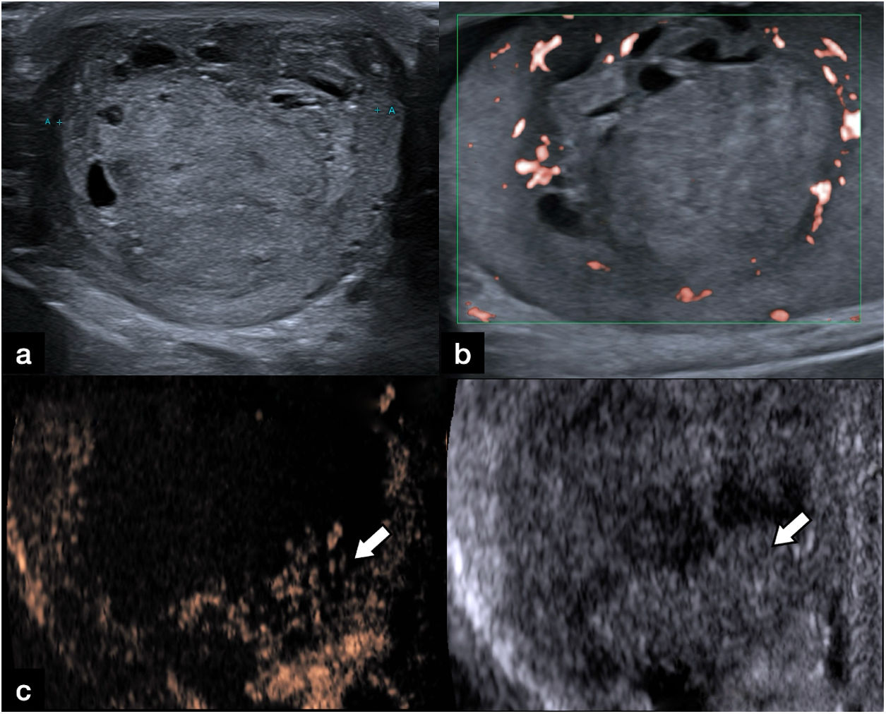 fig0045