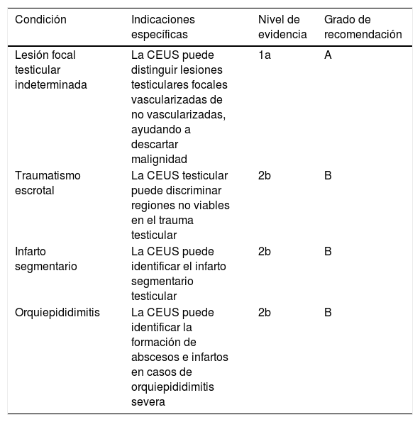 Tablas