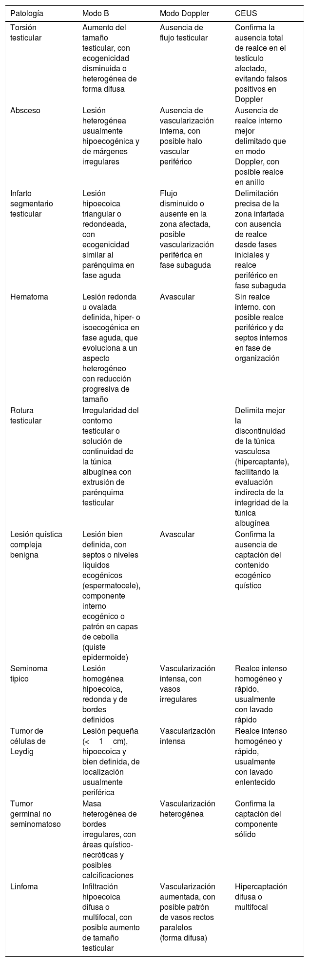 Tablas