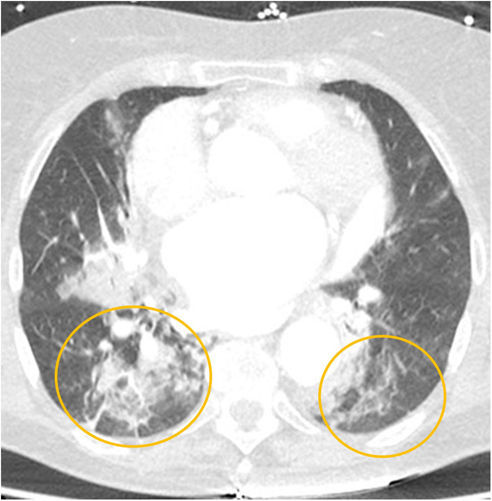 fig0070