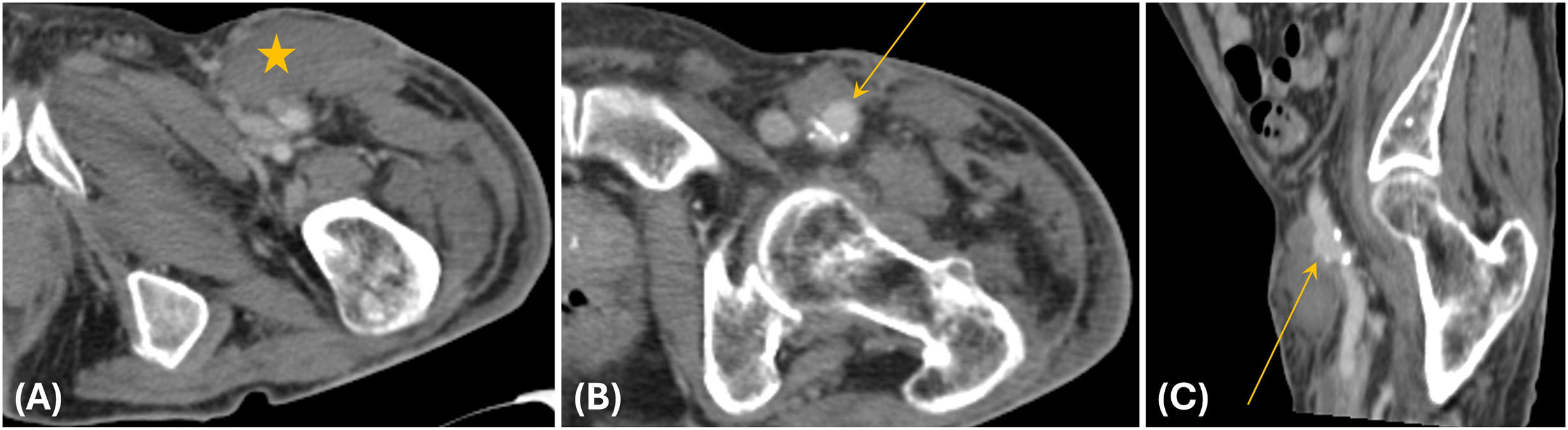 fig0075