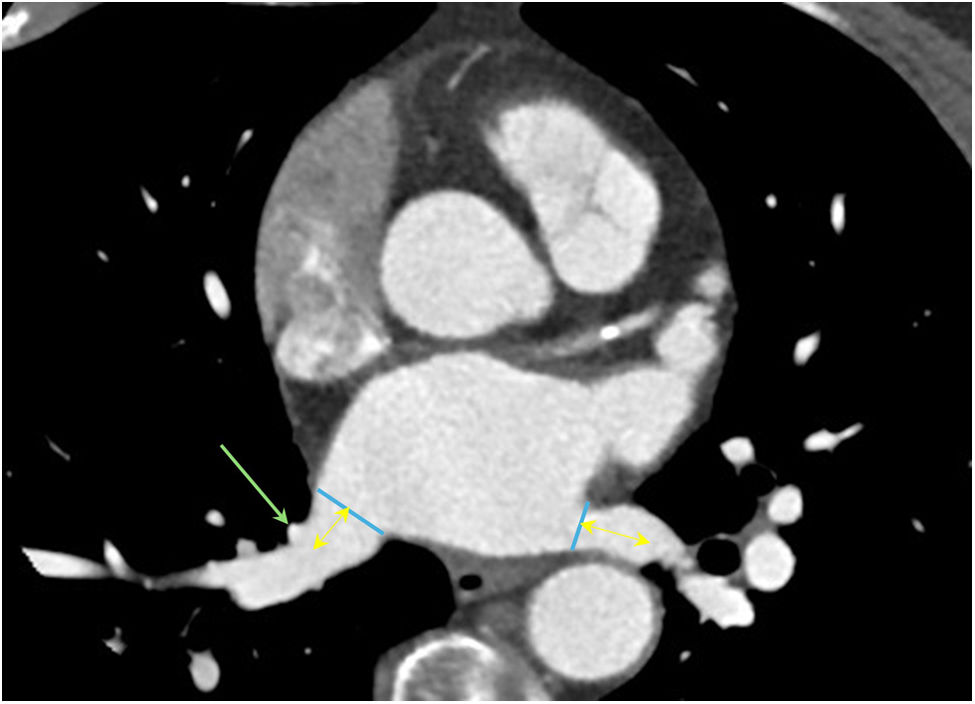 fig0015