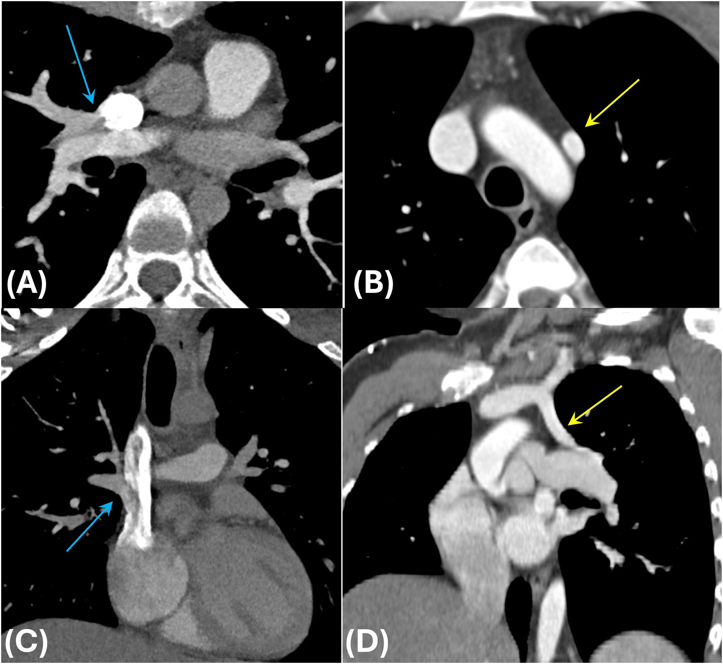 fig0025