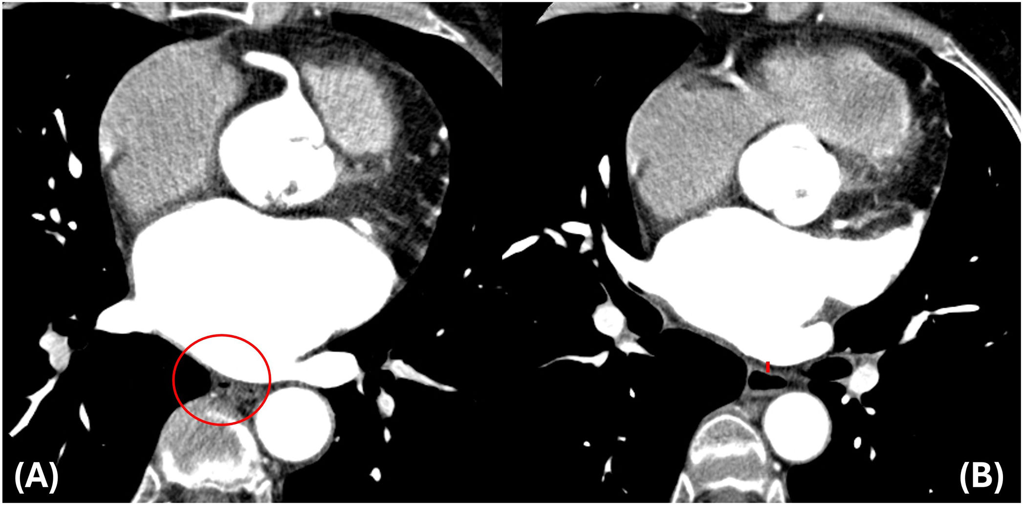 fig0030