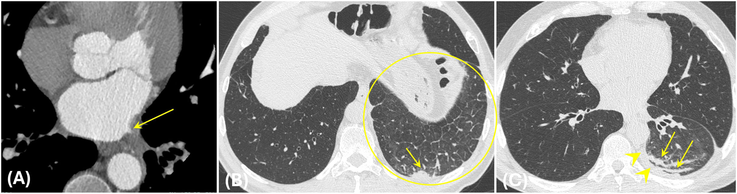 fig0045