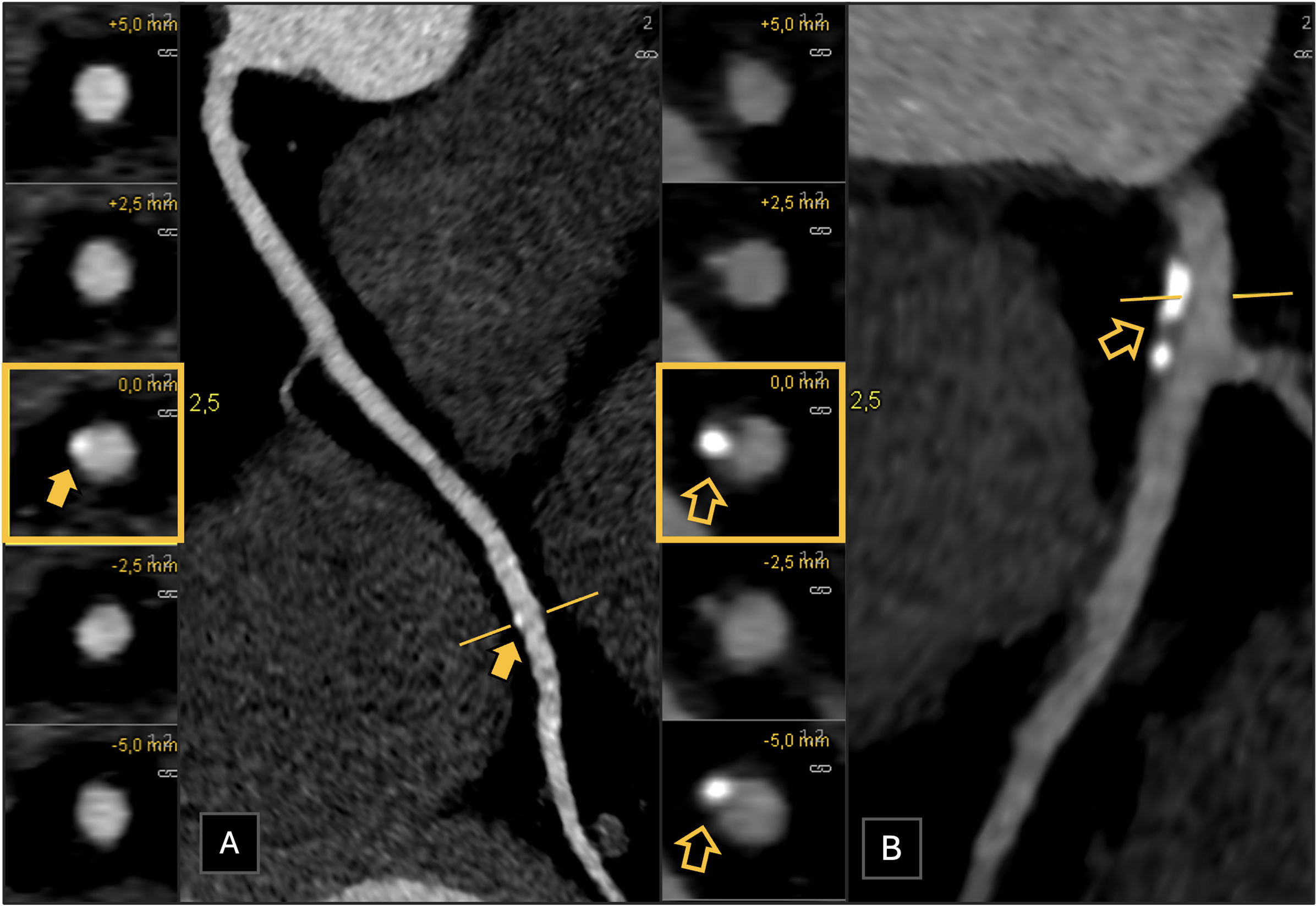 fig0010