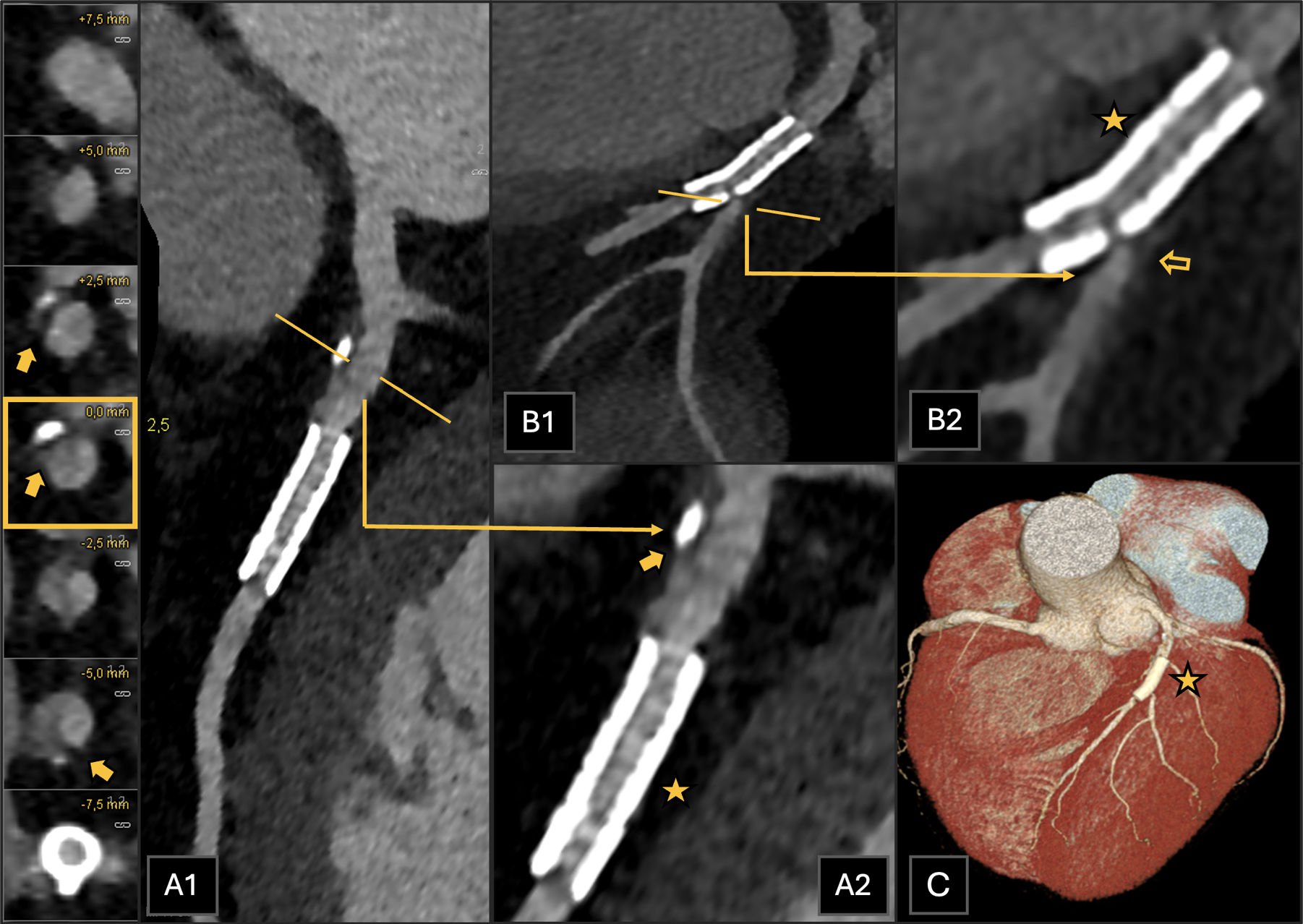 fig0020