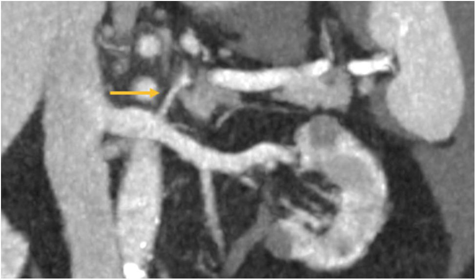 fig0005
