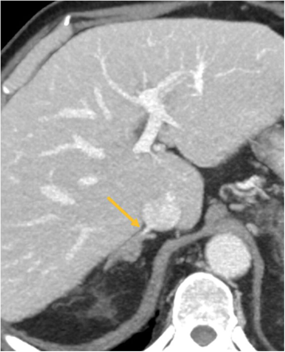 fig0010