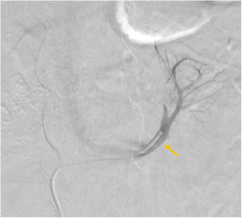 fig0035