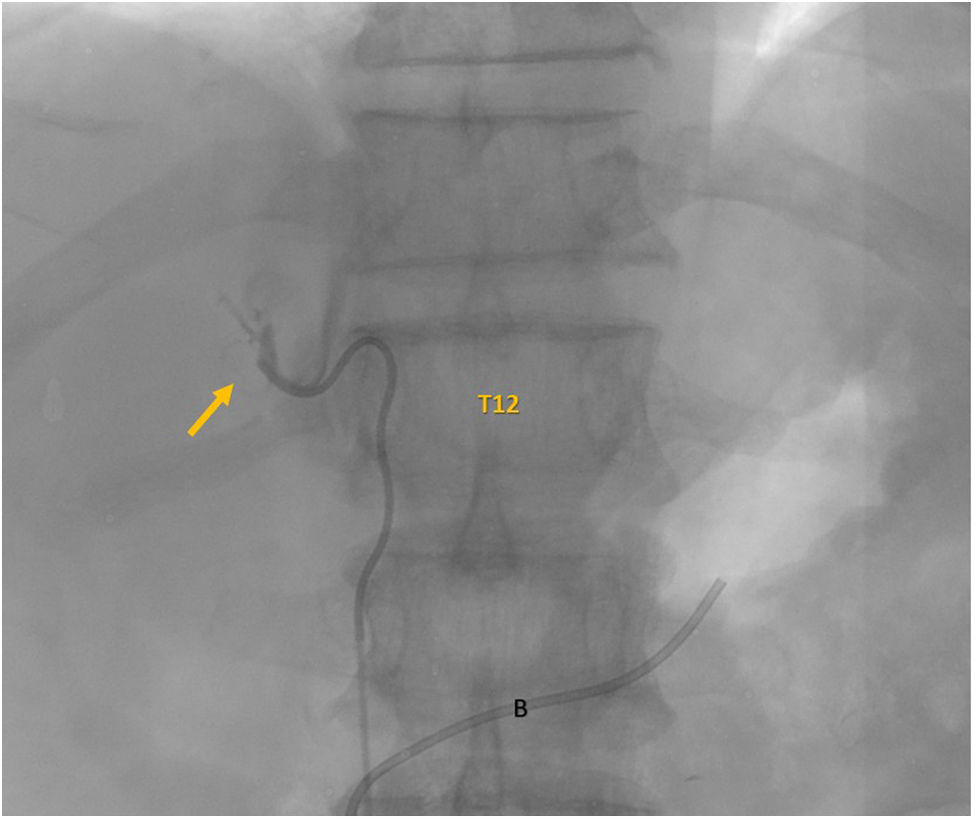 fig0040