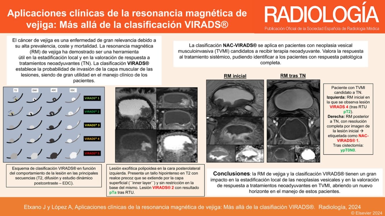 Aplicaciones clínicas de la resonancia magnética de vejiga: más allá de ...