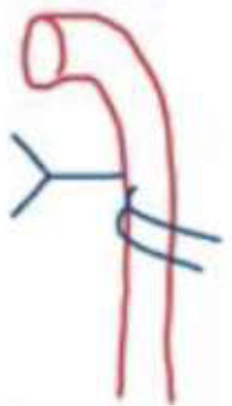 202606052141018821