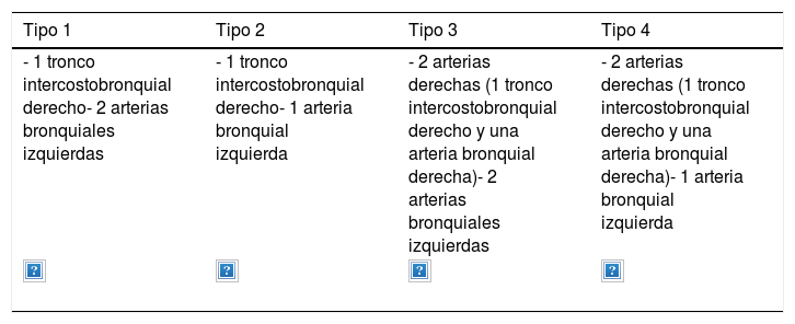 Tablas
