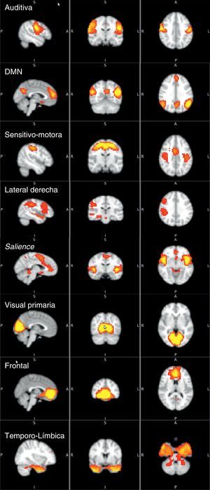 Principales redes funcionales en estado de reposo identificadas por ICA.