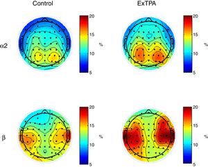 Mapas topográficos que ilustran las diferencias en la potencia espectral entre excombatientes con trastorno de personalidad antisocial (ExTPA) y los controles en alfa-2 y beta. Las regiones azules indican una potencia relativa del 5%, que va aumentando hasta un 20%, que corresponde a las zonas rojas. En general se encuentra una mayor potencia espectral en los ExTPA que en los controles.