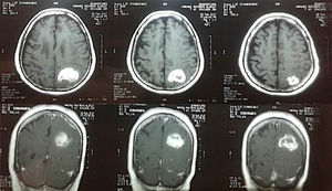 Contrast nuclear magnetic resonance imaging.