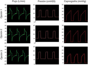 Simulación ventilación mandatoria en paciente con ARDS. Las 3 opciones estudiadas mantuvieron la presión seleccionada en el equipo de VNI y evitaron la reinhalación de CO2.