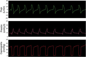 Simulación ventilación espontánea en paciente sano con la opción 3.