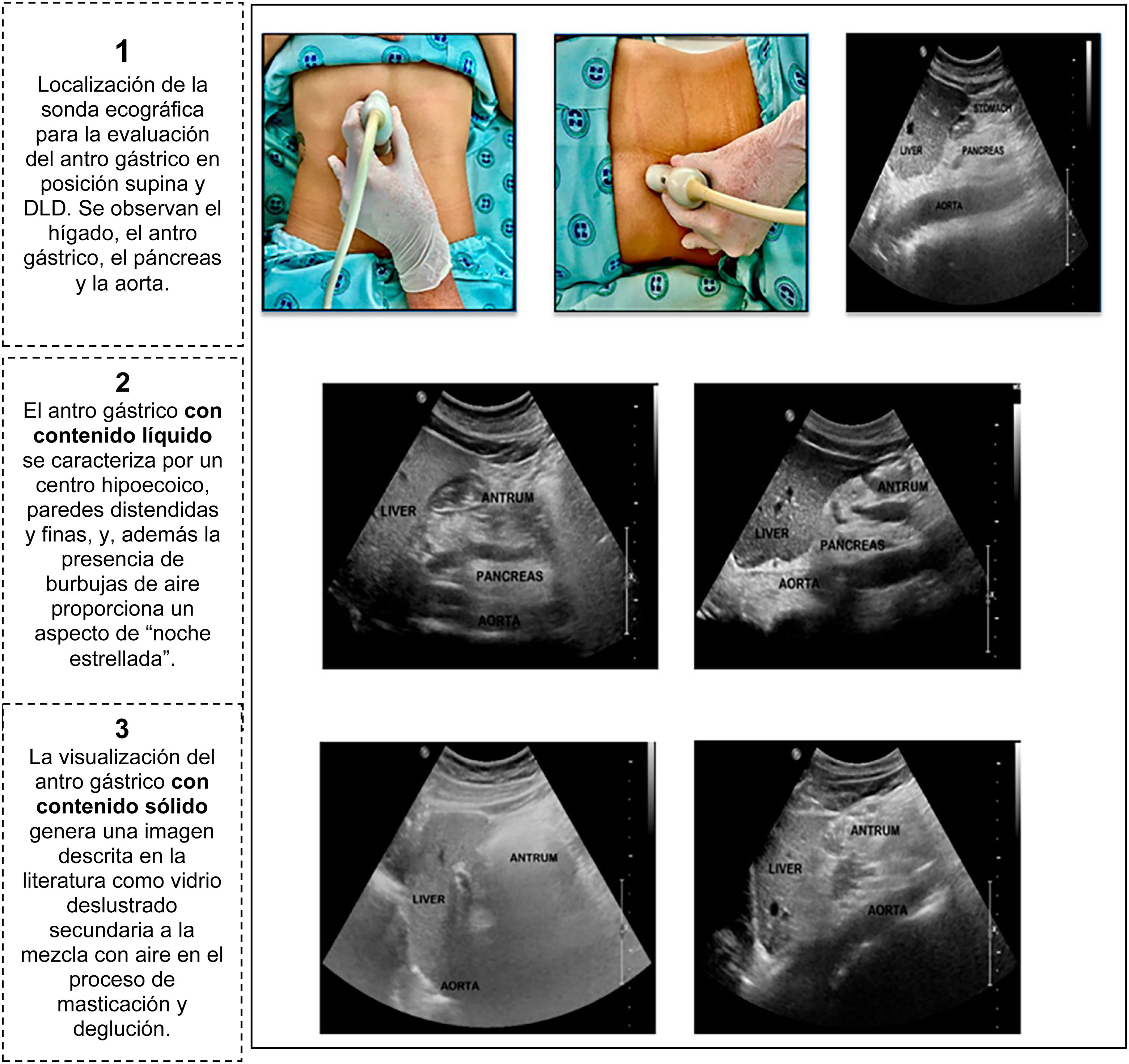 fig0005