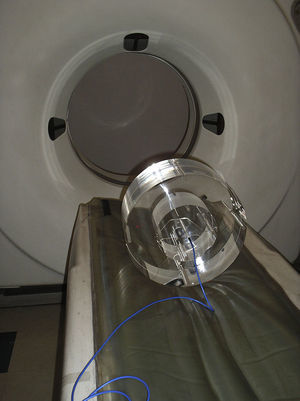 Fantoma abdominal y craneal de acrílico (PMMA) donde puede observarse la cámara de ionización colocada en el orificio central.