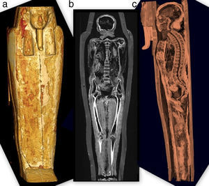 (a) Reconstrucción tridimensional del ataúd en vista coronal. (b) Tomografía computada multicorte, plano coronal, muestra a la momia dentro de su ataúd. (c) Vista sagital tridimensional con ventana ósea del esqueleto y el ataúd.