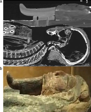 (a) Vista sagital de Herwodj, a nivel de la región maxilofacial, con máscara facial de madera en la misma ubicación. (b) Fotografía de la máscara facial del ataúd de la misma momia.